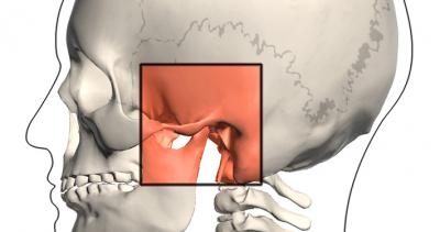Çene Eklem Bozuklukları